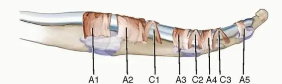 صورة توضيحية لـ إصبع الزنادي: دليلك الشامل للعلاج والتعافي مع الأستاذ الدكتور محمد هطيف