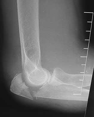 Illustration 172 for OrthoCash: Trauma MCQs & Cases for a yearold woman