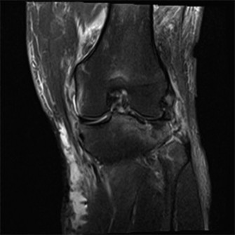 Emergency Case Knee Injuries: What's Your Next Critical Step?
