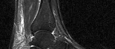 Illustration 106 for OrthoCash: Trauma MCQs & Cases for a yearold woman