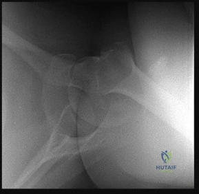 Illustration of knee selfassessment online - Dr. Mohammed Hutaif