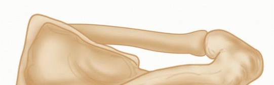 Illustration 12 for Mastering the Treatment of Recurrent Posterior Shoulder Instability