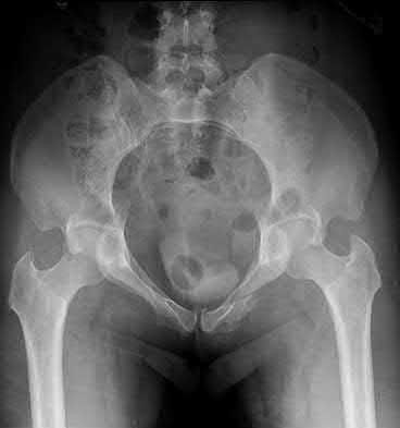 Illustration 192 for OrthoCash: Trauma MCQs & Cases for a yearold woman