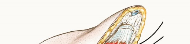 Illustration 14 for Below-Knee Amputation: Maximize Your Below-Knee Recovery & Function