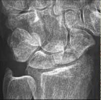 صورة طبية: دليل الأستاذ الدكتور محمد هطيف الشامل لأمراض وإصابات اليد والمعصم في صنعاء