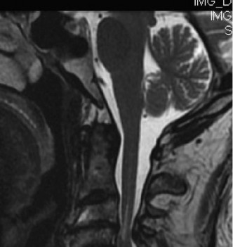 Illustration 3 for Master Orthopedic Spine Cases: Sharpen Your Diagnostic Skills