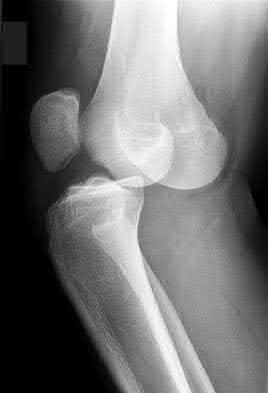 Illustration 68 for OrthoCash: Trauma MCQs & Cases for a yearold woman