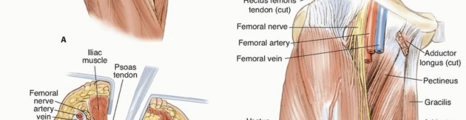 Adductor and Iliopsoas Release: End Hip Flexor Contractures