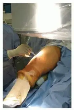 تفاوت طول الساقين لدى الأطفال: دليل شامل للآباء مع الأستاذ الدكتور محمد هطيف