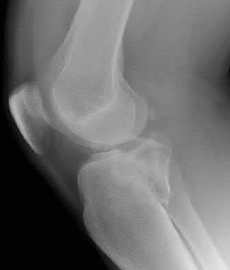Illustration 39 for OrthoCash: Trauma MCQs & Cases for a yearold woman