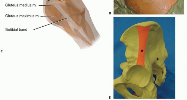 Illustration 16 for Emergency Fixation of the Pelvis: Control Bleeding & Restore Stability