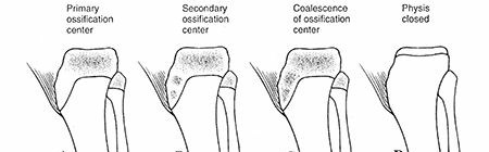 Illustration 25 for Master Pediatric Femoral Shaft & Knee Fractures: Interactive Module