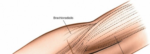 Illustration 72 for Mastering Elbow Approaches: Applied Surgical Anatomy for Precision