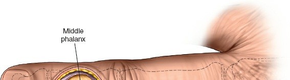 Illustration 7 for Unlock Easier Access: Dorsal Approach for Phalanges and Interphalangeal Joints