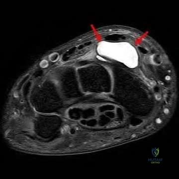 Master SAE Anatomy MCQs: The Preferred Response Guide