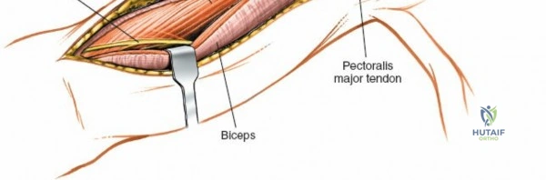 Clinical Image