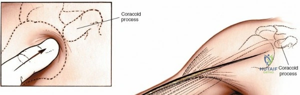 Clinical Image