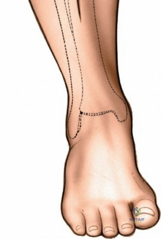 Anterior Approach to the Tibia: Comprehensive Surgical Anatomy, Plating Biomechanics, and Techniques