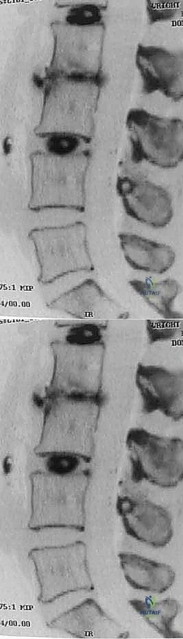 Clinical Image