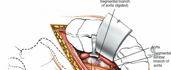Clinical Image