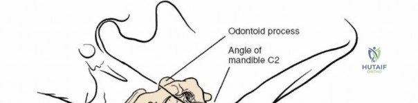 Anterior Cervical Spine Surgery: Comprehensive Guide to Deep Cervical Fascia & Surgical Anatomy