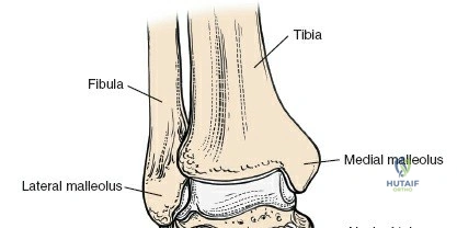 Approaches to Femur