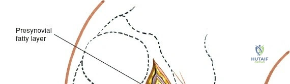 Clinical Image