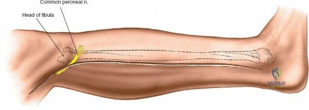 Illustration of distal to proximal - Dr. Mohammed Hutaif