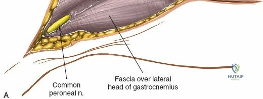 Clinical Image