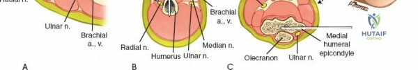 Illustration of approaches for external - Dr. Mohammed Hutaif