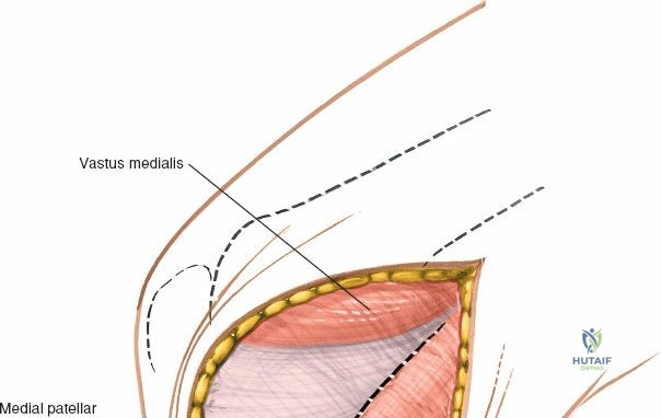 Clinical Image