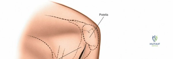 Clinical Image