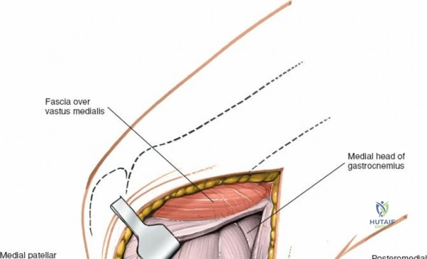 Clinical Image