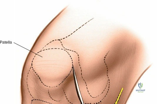 Clinical Image