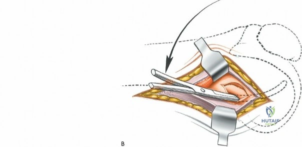 Clinical Image