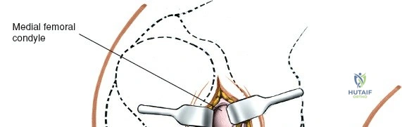 Clinical Image