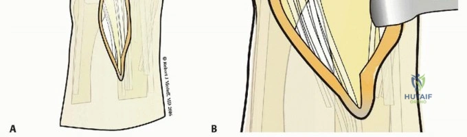 Arab Ortho Board MCQs - Part 27
