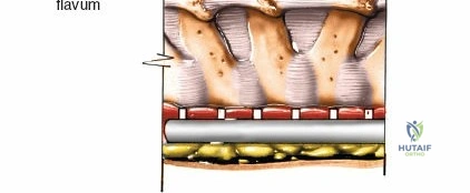 Arab Ortho Board MCQs - Part 4