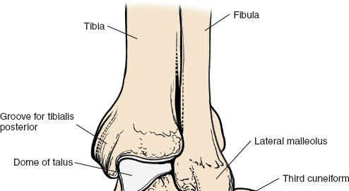 Illustration 179 for Optimized Approaches to the Dorsum of the Foot & Ankle