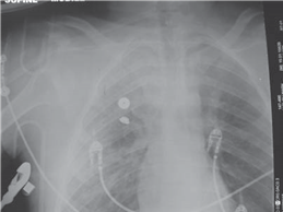 Illustration 9 for Ace Your FRCS: Key Questions in Trauma & Orthopaedics
