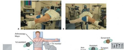 Illustration 150 for Understanding Hip Arthroscopy: The Basics Explained