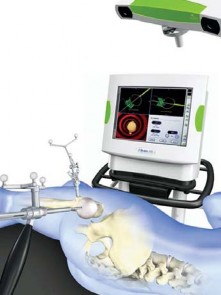 Illustration 7 for Minimizing Risks: Computer Navigation in Hip Resurfacing Arthroplasty