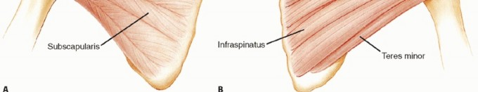 Illustration 2 for Bankart Repair & Inferior Capsular Shift: Solving Shoulder Instability