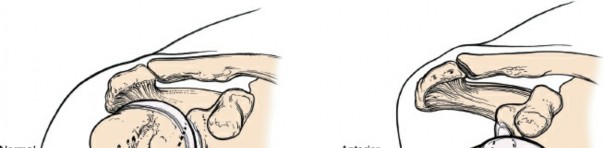 Illustration 39 for Enhance Anterior Shoulder Surgery: Crucial Joint Applied Surgical Anatomy