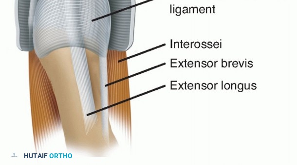 Illustration 7 for Hammer Toe Correction: Understanding the Extensor Digitorum Longus