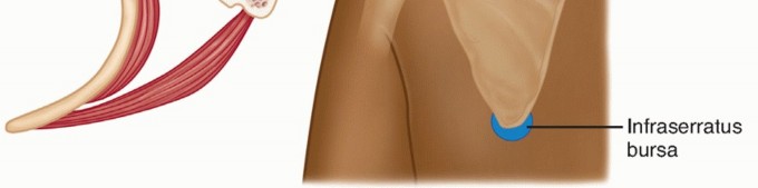 Illustration 2 for Solving Snapping Scapula: Is resection of the superomedial your option?