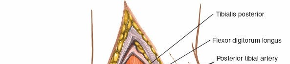 Illustration 53 for Optimized Approaches to the Dorsum of the Foot & Ankle