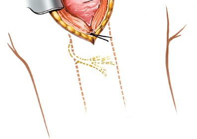 Illustration 106 for Essential Guide: Mastering Every Approach to the Shoulder