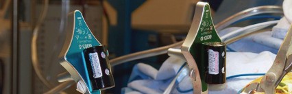 Illustration 22 for Optimize Tibial Component Alignment: Techniques for TKA Success