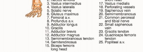 Illustration 6 for Mastering Above-Knee Amputation: Essential Surgical Insights